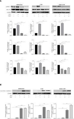 Targeting the <mark class="highlighted">Endothelin-1</mark> Receptors Curtails Tumor Growth and Angiogenesis in Multiple Myeloma